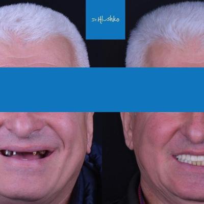 Perevtilennia Posmishky 11