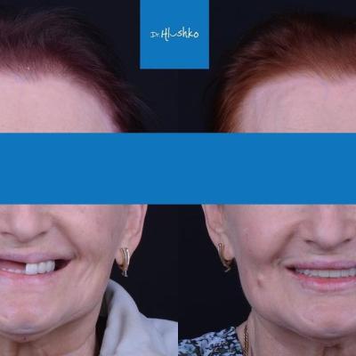 Perevtilennia Posmishky 1