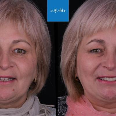 Perevtilennia Posmishky 2