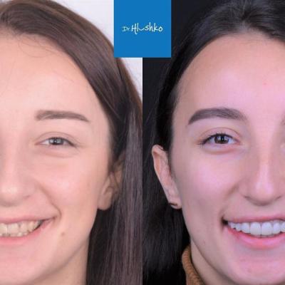 Perevtilennia Posmishky 4