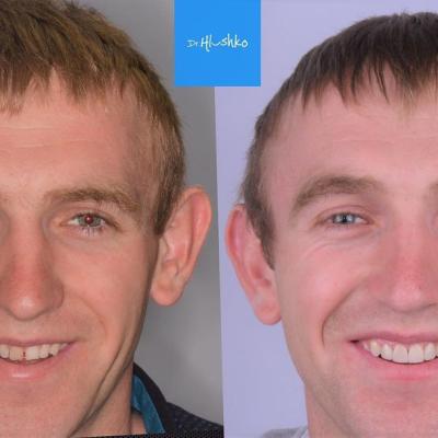 Perevtilennia Posmishky 5