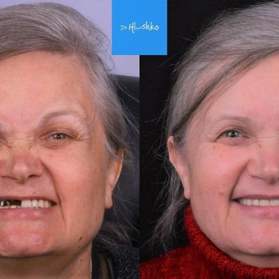 Perevtilennia Posmishky 6