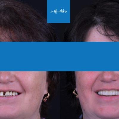 Perevtilennia Posmishky 8