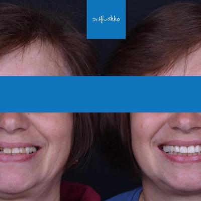 Perevtilennia Posmishky 9