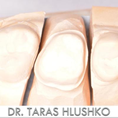 Protezuvannia Na Zubakh V003 001