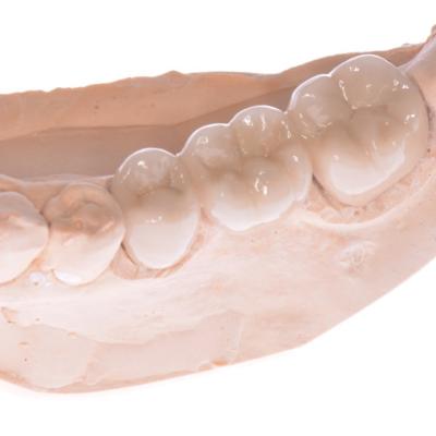 Protezuvannia Na Zubakh V006 I007