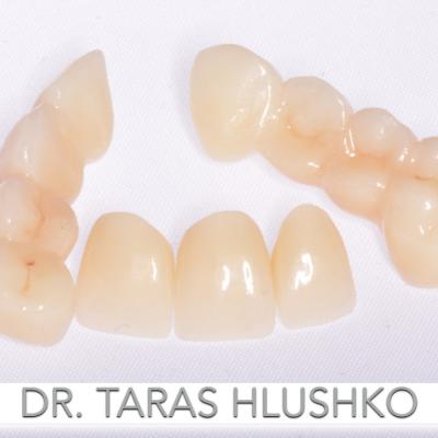 Protezuvannia Na Zubakh V9 I2