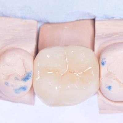 Protezuvannia Na Zubakh V10 I4