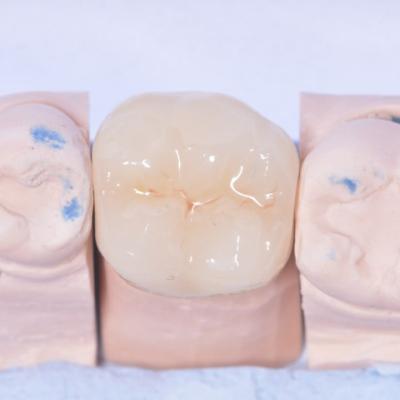 Protezuvannia Na Zubakh V11 I4