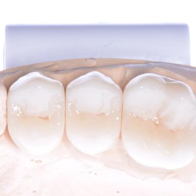 Protezuvannia Na Zubakh V002 001